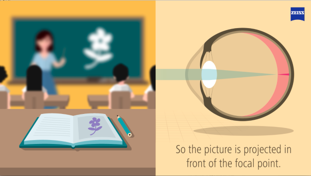 Was ist Myopia?